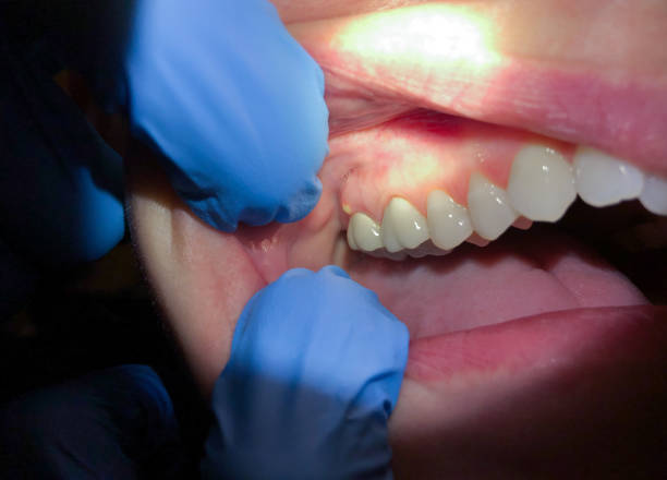 Best Emergency Dental Services Near Me  in Buffalo, WY