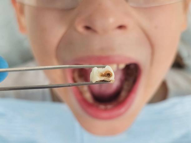 Best Knocked-Out Tooth Emergency  in Buffalo, WY